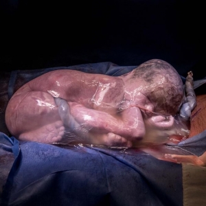 Bebê que nasceu dentro da bolsa gestacional. A imagem foi premiada pela Associação Internacional de Fotógrafos Profissionais de Nascimento. (Foto: Daniela Justus/ Arquivo pessoal)