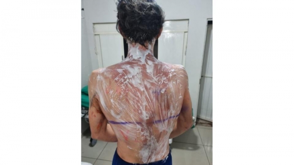 Foto: Correio do Ar