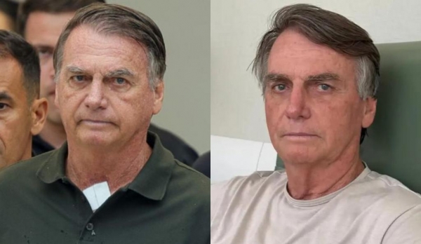 Relatórios médicos e novos fatos entram na reta final de análise do STF sobre prisão domiciliar de Jair Bolsonaro (Foto: Agência Brasil | Redes sociais)